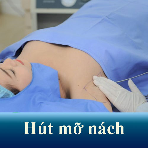 hut mo nach 1