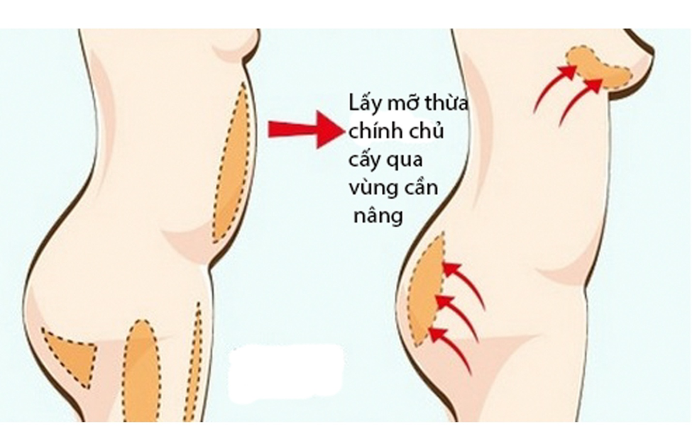 nang nguc tu than1